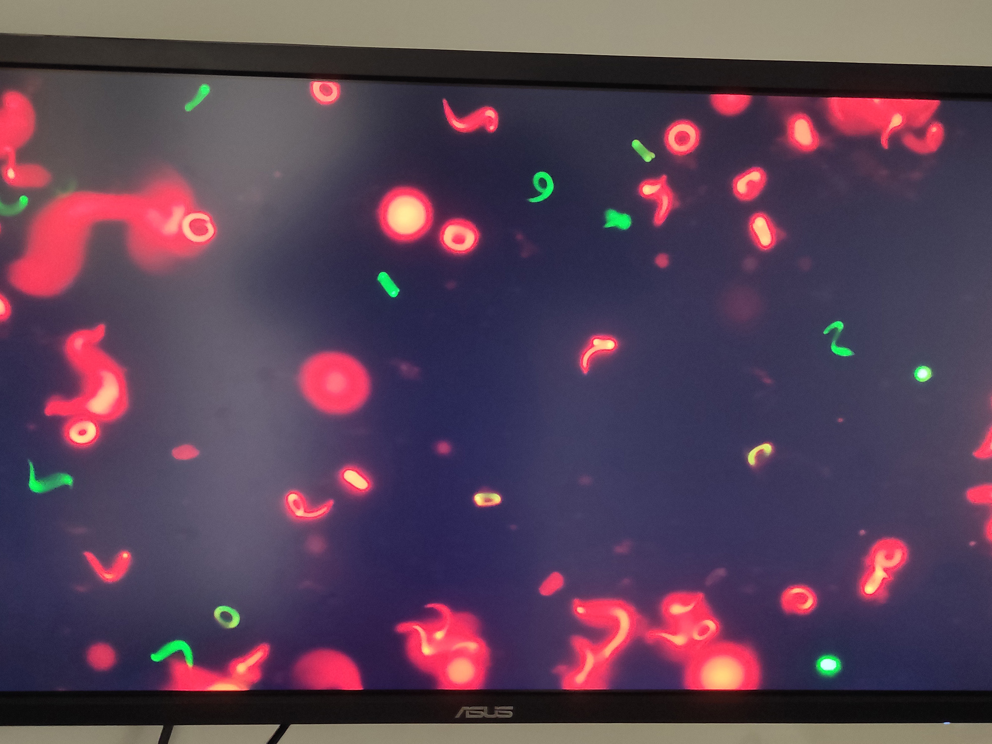 This computer screen image displays live frog sperm. The sperm that is red-colored is dead.